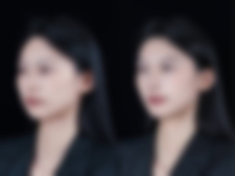 【上海圣宝整形医疗美容医院诊疗设备：】