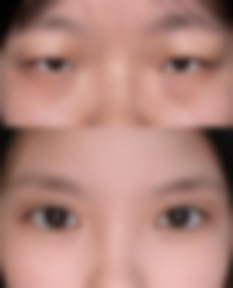 下颌不对称治疗的价格因素