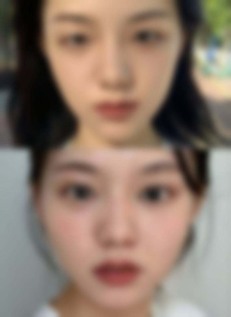 【贵阳星妍芭莎美容医院植发科患者口碑评价：】