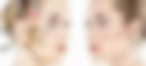 嘴唇整形一般收费大概是多少