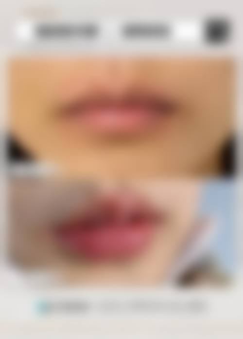 【郑州**医疗美容诊所（技术总院）患者口碑评价：】