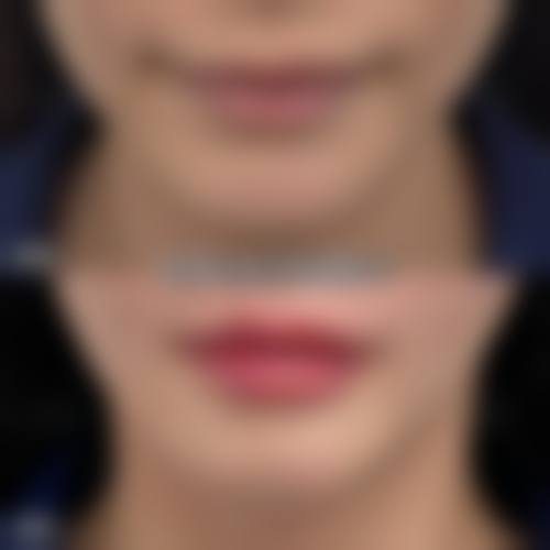 【郑州**医疗美容诊所（技术总院）参考价格表：】