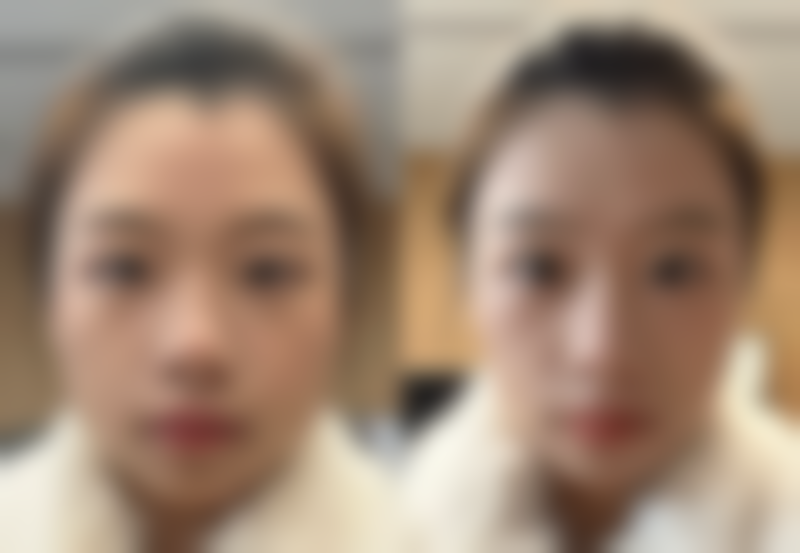 【合肥蜀山莱司美医疗美容门诊部特色项目：】