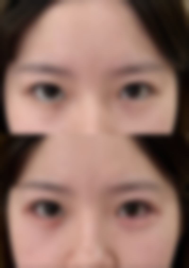 种植头发哪家医院好