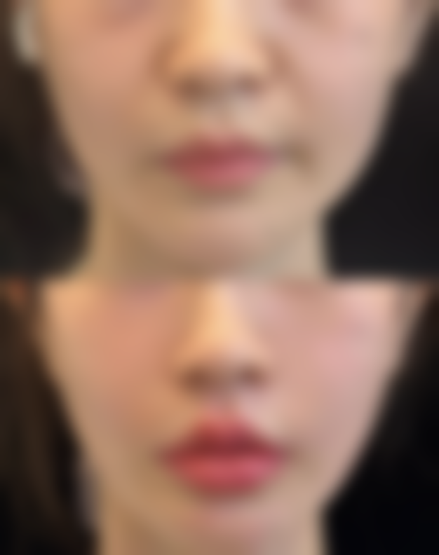 【吕琴医生怎么预约挂号？】