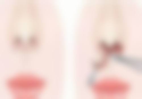 【林柱焕医生技术特点】