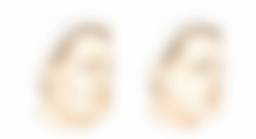 瘦脸针间隔多久打一次更好