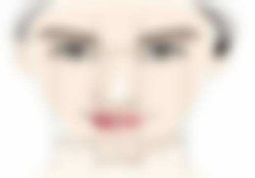 阴式子宫切除 + 阴道前后壁修补术