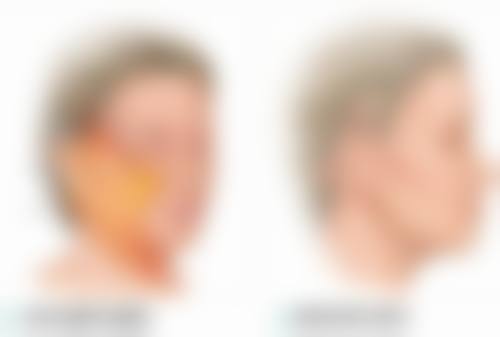 如何降低阴道紧缩术的风险