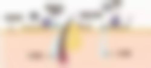 不同体质对修复的影响