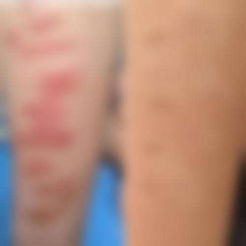 【袁定芬医生怎么预约挂号？】