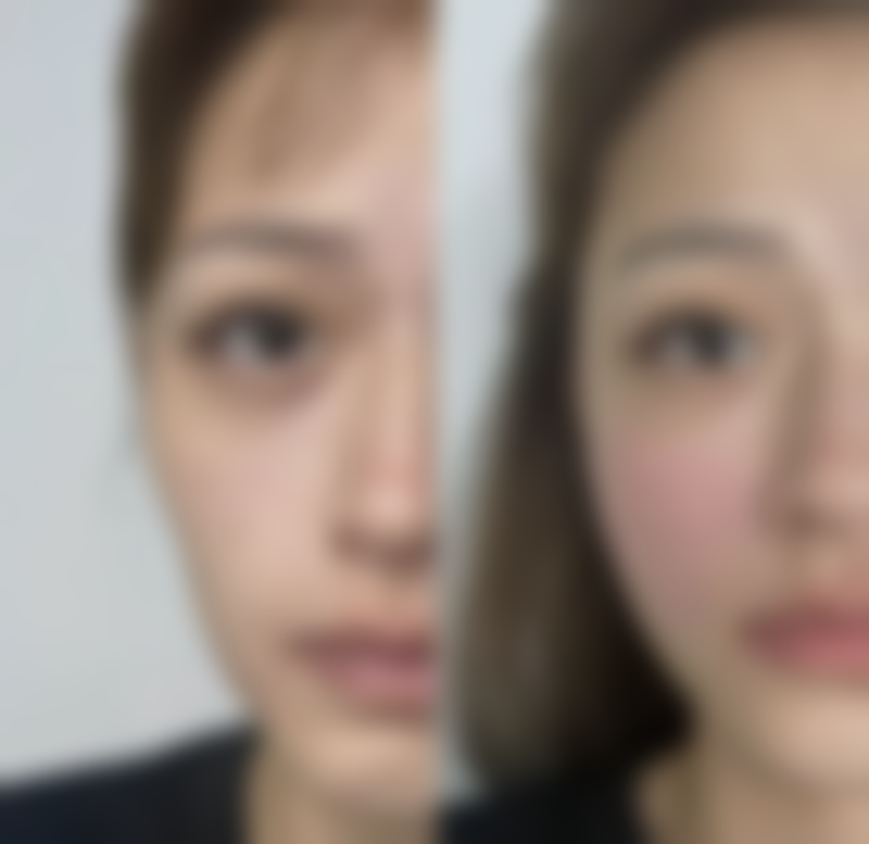 【随州华美整形美容患者口碑评价：】