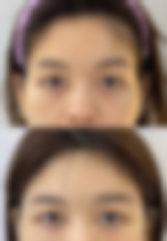 【随州华美整形美容怎么预约挂号?】