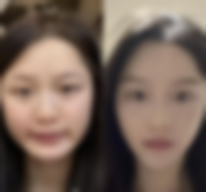 如何选择合适的医院和医生