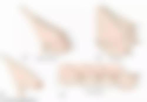 不同地区丰太阳穴的优质医美机构推荐