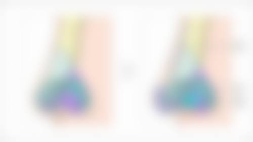 第一次打瘦脸针效果明显吗？揭秘首次注射瘦脸针显著见效的原因及3大关键影响因素！ 