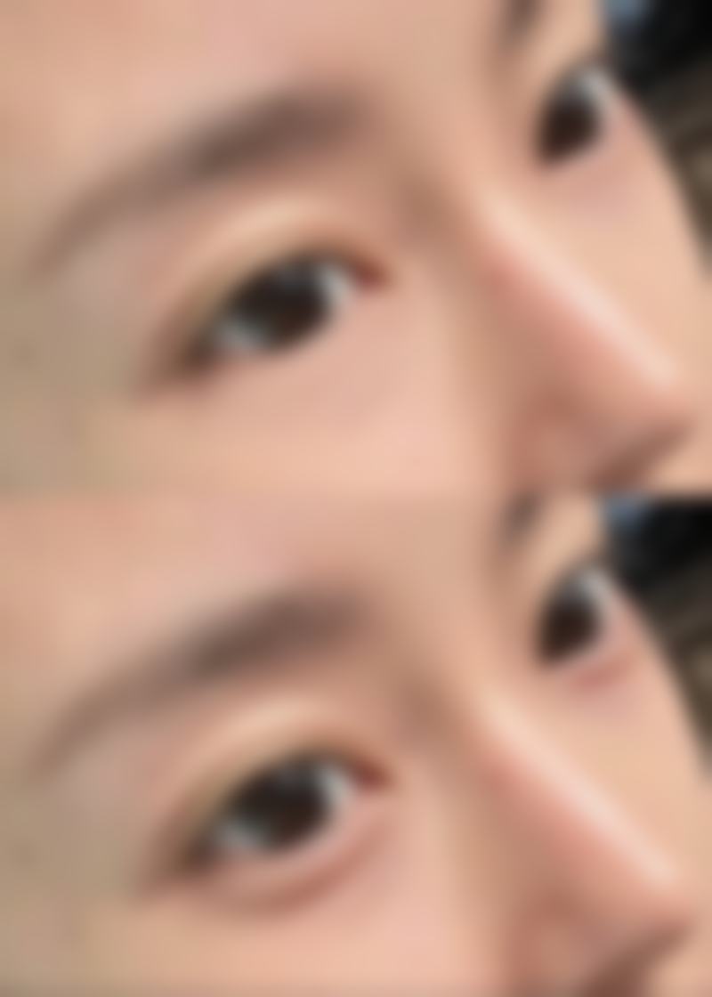 【汕头伊丽莎白医疗美容整形是正规的吗?】