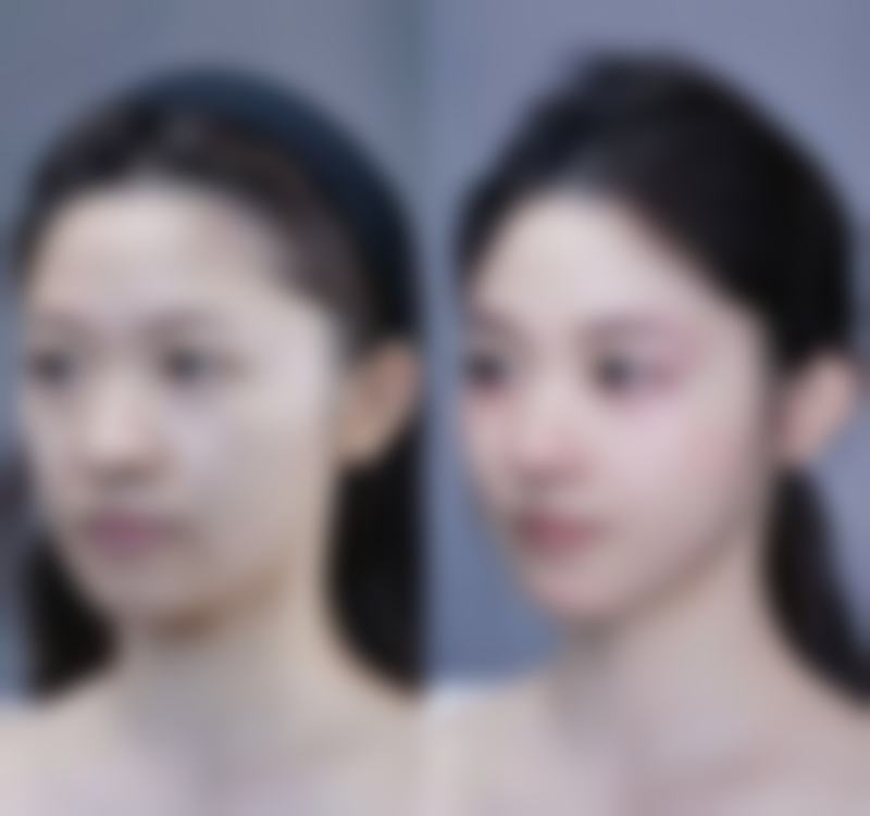 丰太阳穴的价格参考