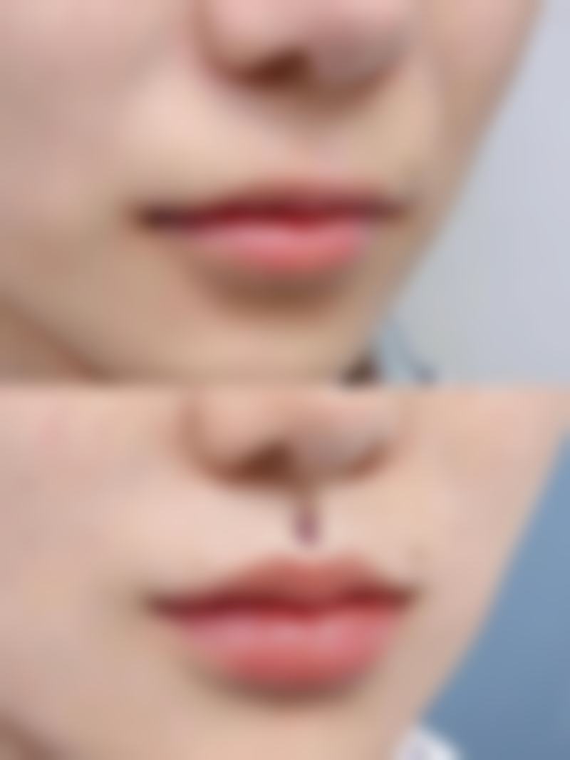 【汕头伊丽莎白医疗美容整形患者口碑评价：】