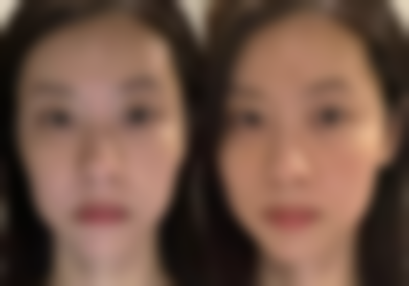 【邯郸薇斯医疗美容门诊部参考价格表：】