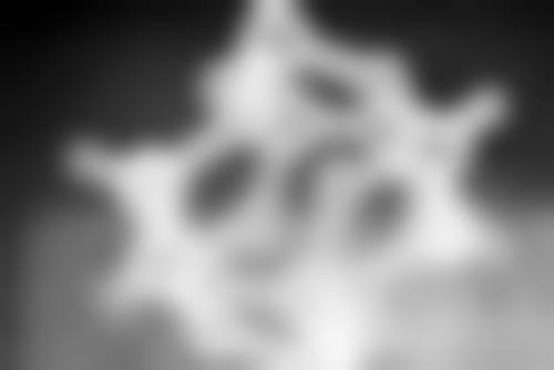 瘦脸针可以打吗?有没有副作用