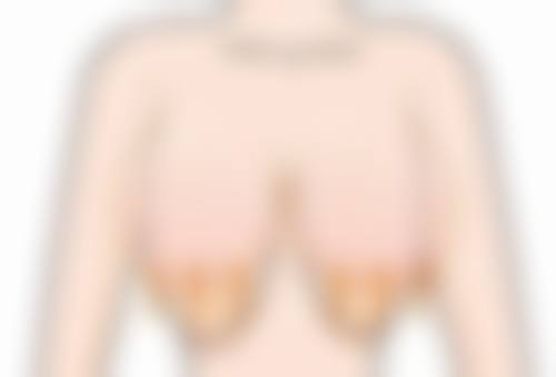 美白针能坚持多久？揭秘影响维持时间的5大因素，教你延长美白效果至最长！ 