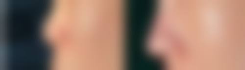 局部修饰小技巧