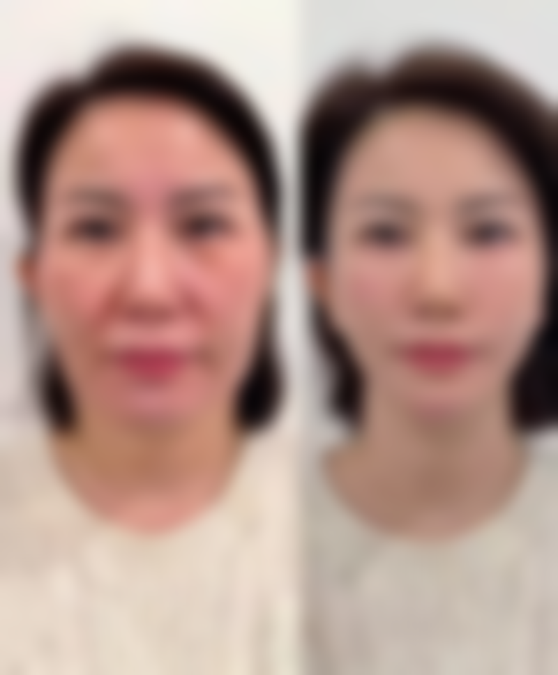 【宫崎SkinClinic诊疗设备：】