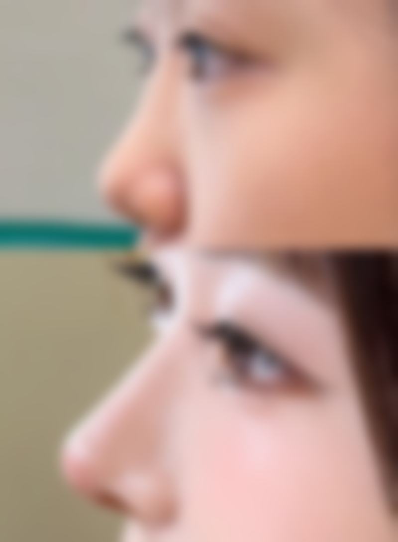 【马伟欢医生擅长项目：】