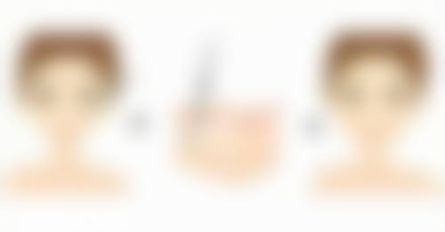 什么情况不能做植发手术