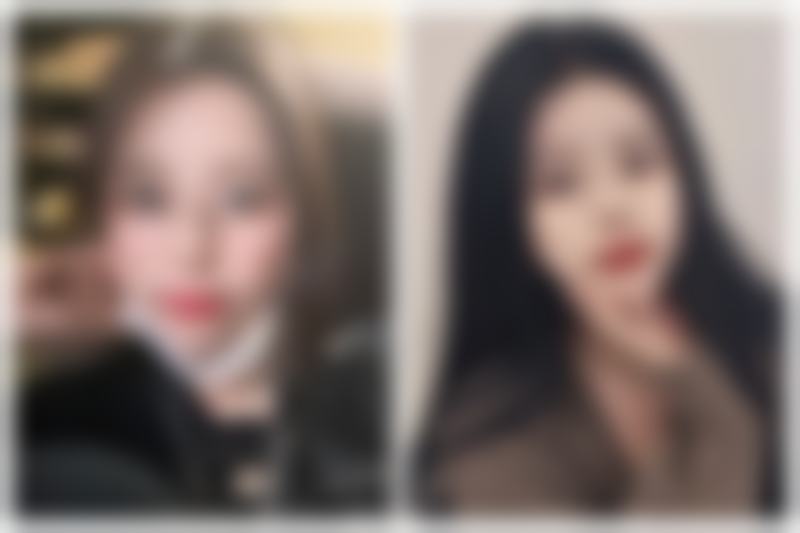 瘦脸针一般打50单位还是100单位