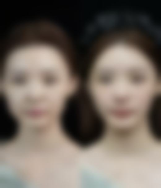 瘦脸针的危害和副作用