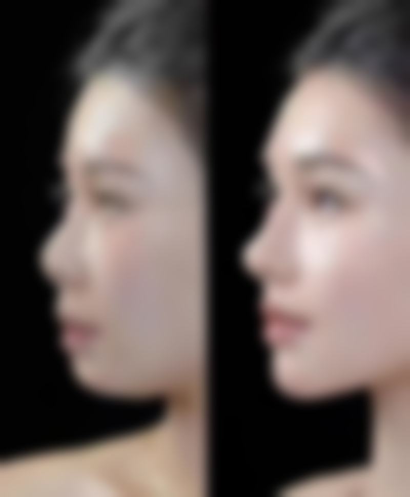 【秦皇岛茗妃医疗美容诊所特色项目：】