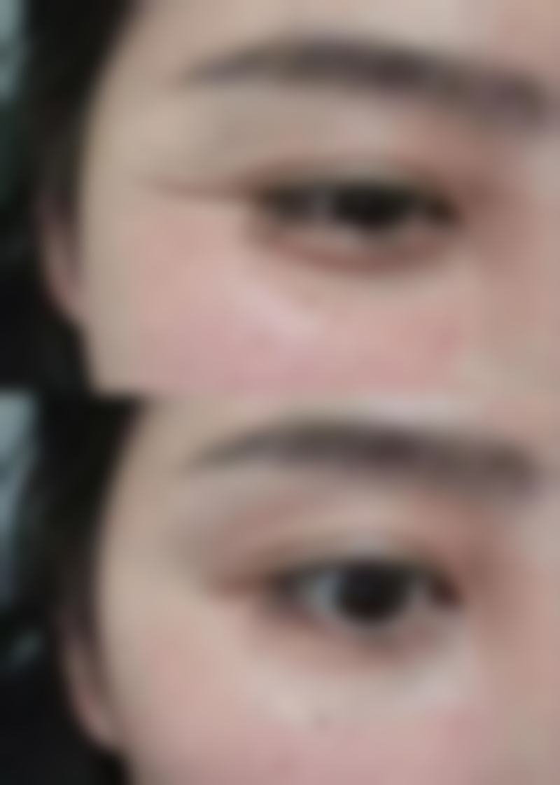 【枣庄悦然整形医院怎么预约挂号?】