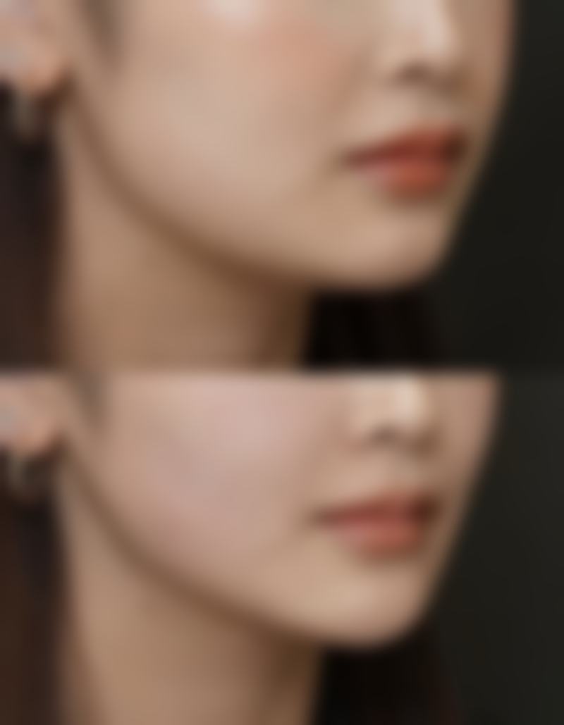 什么情况不适合毛发种植？这5种情况需谨慎，了解后让你避免植发风险，拥有更理智的医美选择！ 