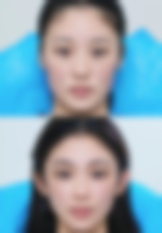 张着嘴睡觉会怎样