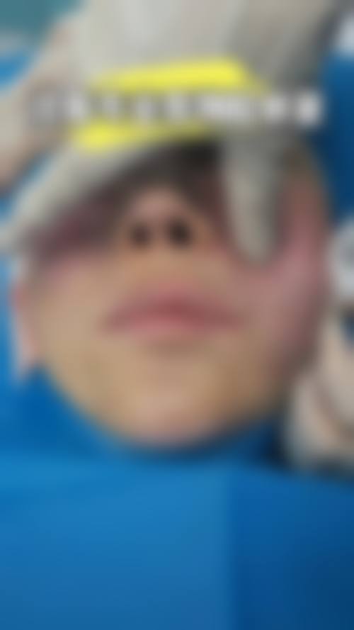 以下是一些项目的参考价格（价格仅供参考，实际以到院面诊为准）：