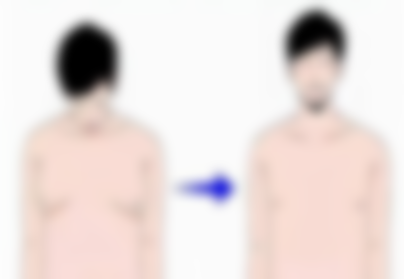 种植头发毛囊会掉出来吗？