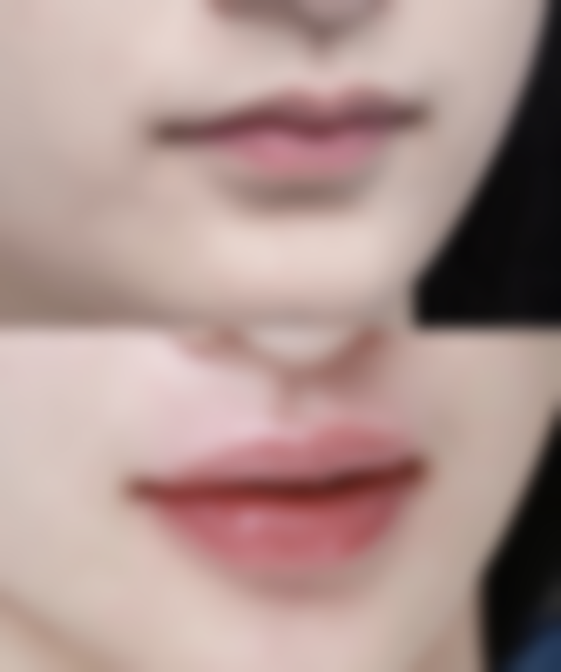 【太原华美整形医院地址：】