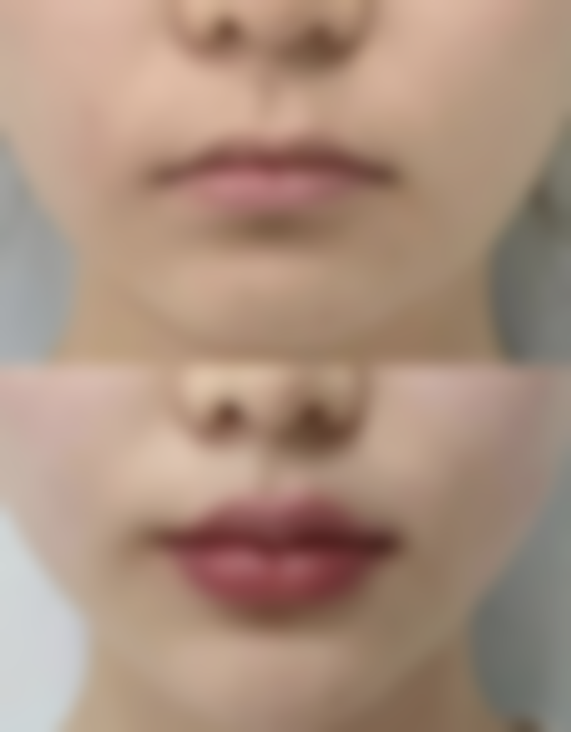 其他靠谱整形医院推荐