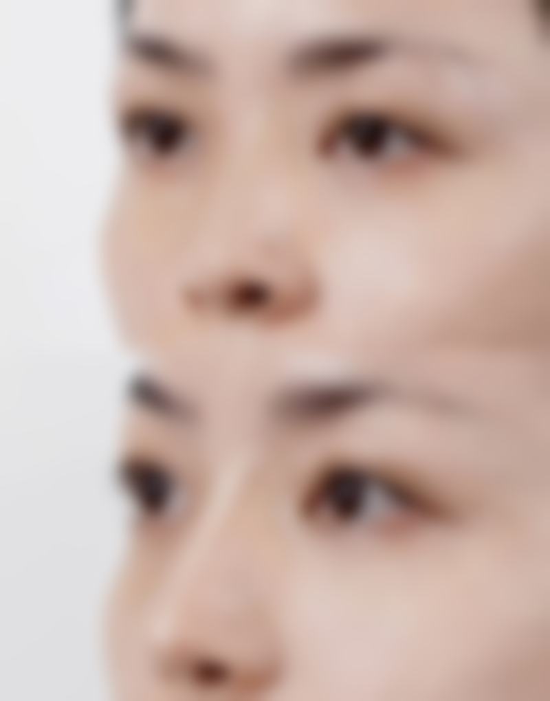 3. “襄阳华妍的注射激光项目真的特别厉害！医生的手法特别娴熟，注射的时候一点都不疼。而且成效立竿见影，脸上的斑点明显淡化了，皮肤也变得更有光泽了。以后还会继续来这里做美容。”