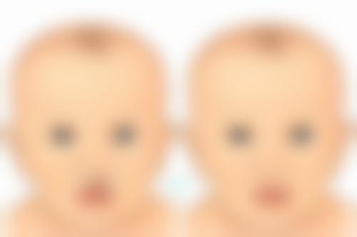 嘴唇太厚可以整吗，有什么危险