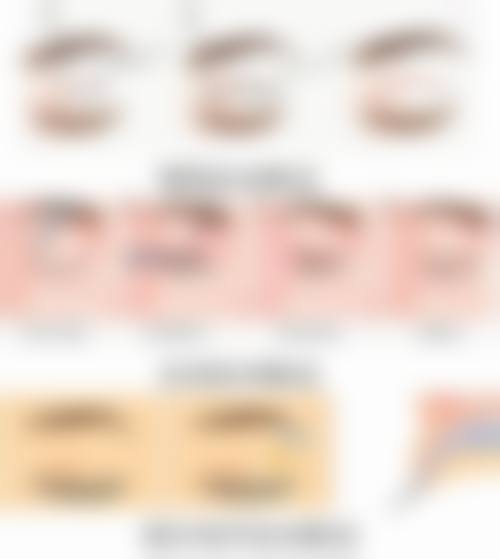 嘴唇厚可以整薄吗图片