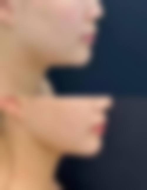 虽然目前没有具体的医生名字信息,但可以知道的是,医院拥有专精的医疗团队。这些医生都具备丰富的临床经验和专精知识,他们会根据患者的具体情况,制定个性化的医疗美容方案,确保患者能够获得满意的成效。