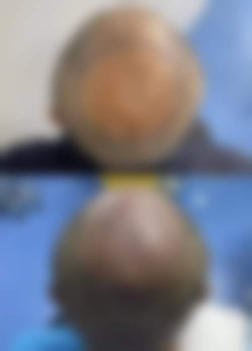 【仝茂盛医生擅长项目】