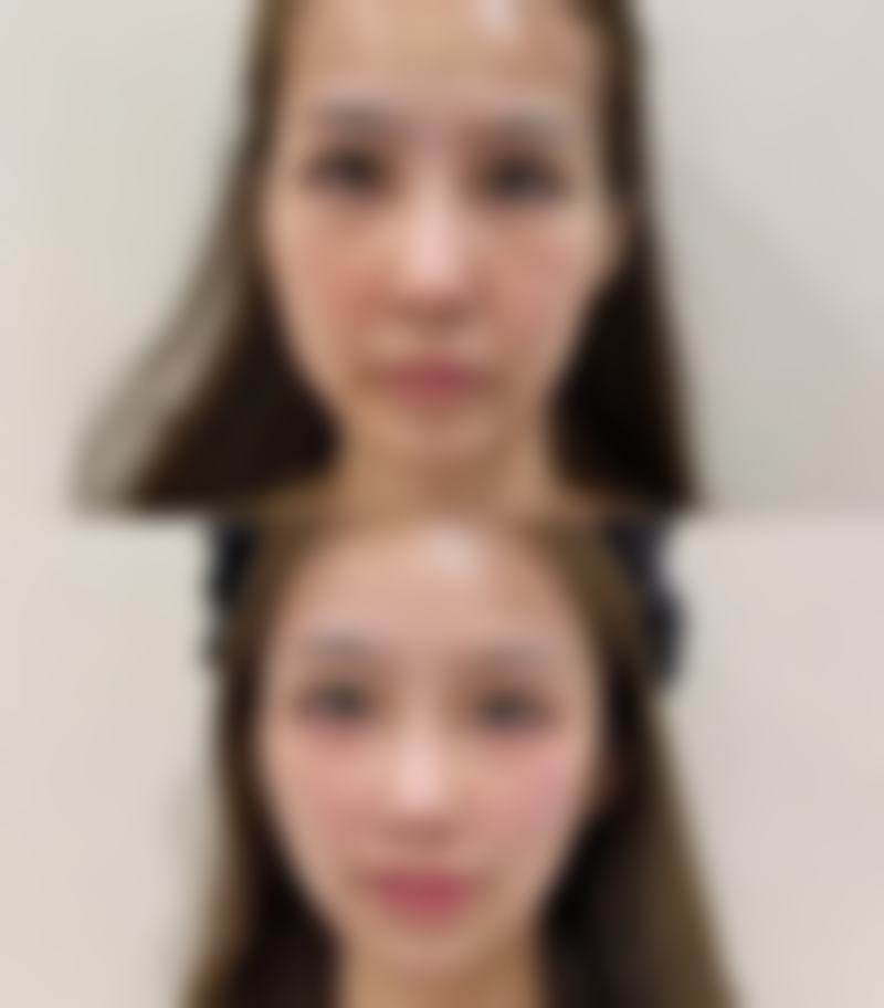 【南通梵妮缇医疗美容诊所参考价格表：】