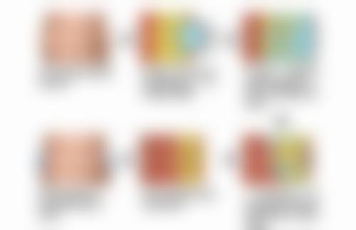 怀孕能打玻尿酸和瘦脸针吗？多少钱