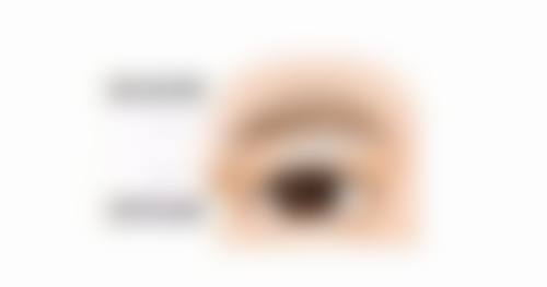 嘴唇上的疤痕能去除吗图片