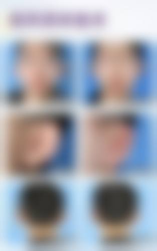 【台州媚焕医疗美容门诊部特色项目：】