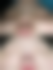 【崔允硕医生口碑】